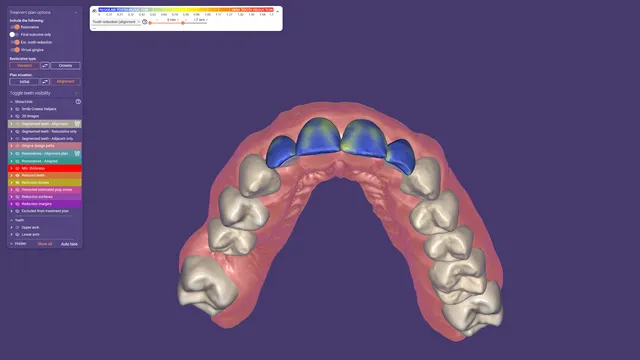 exocad DentalCAD License