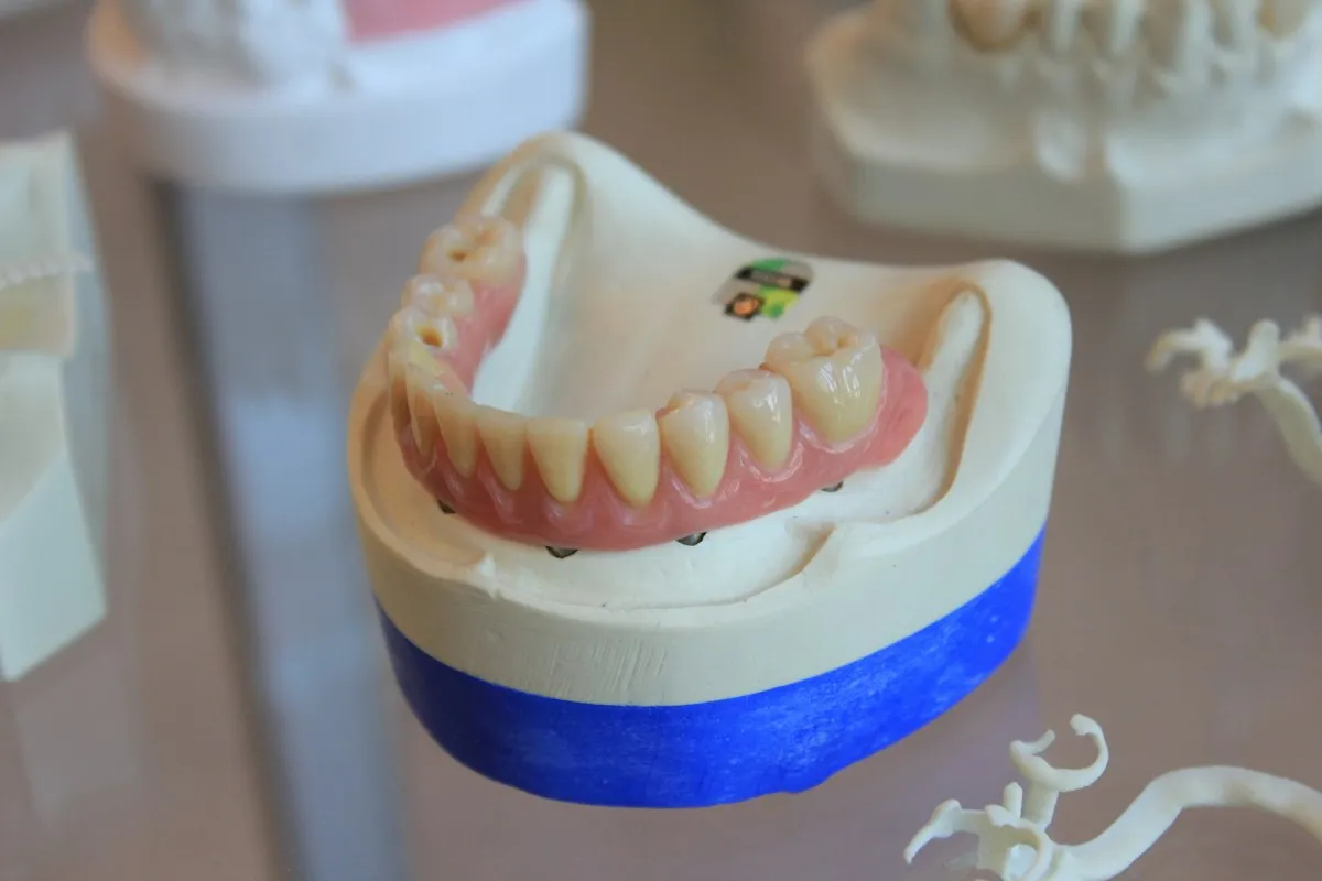 ScanFix Denture Scanning Fixture Kit