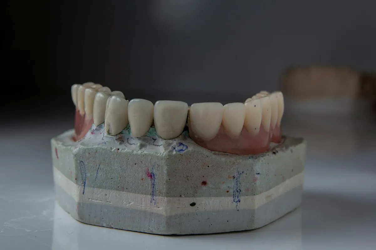 ScanFix Denture Scanning Fixture Kit