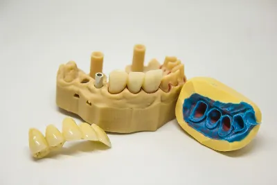 PrecisionFit Implant Scan Body