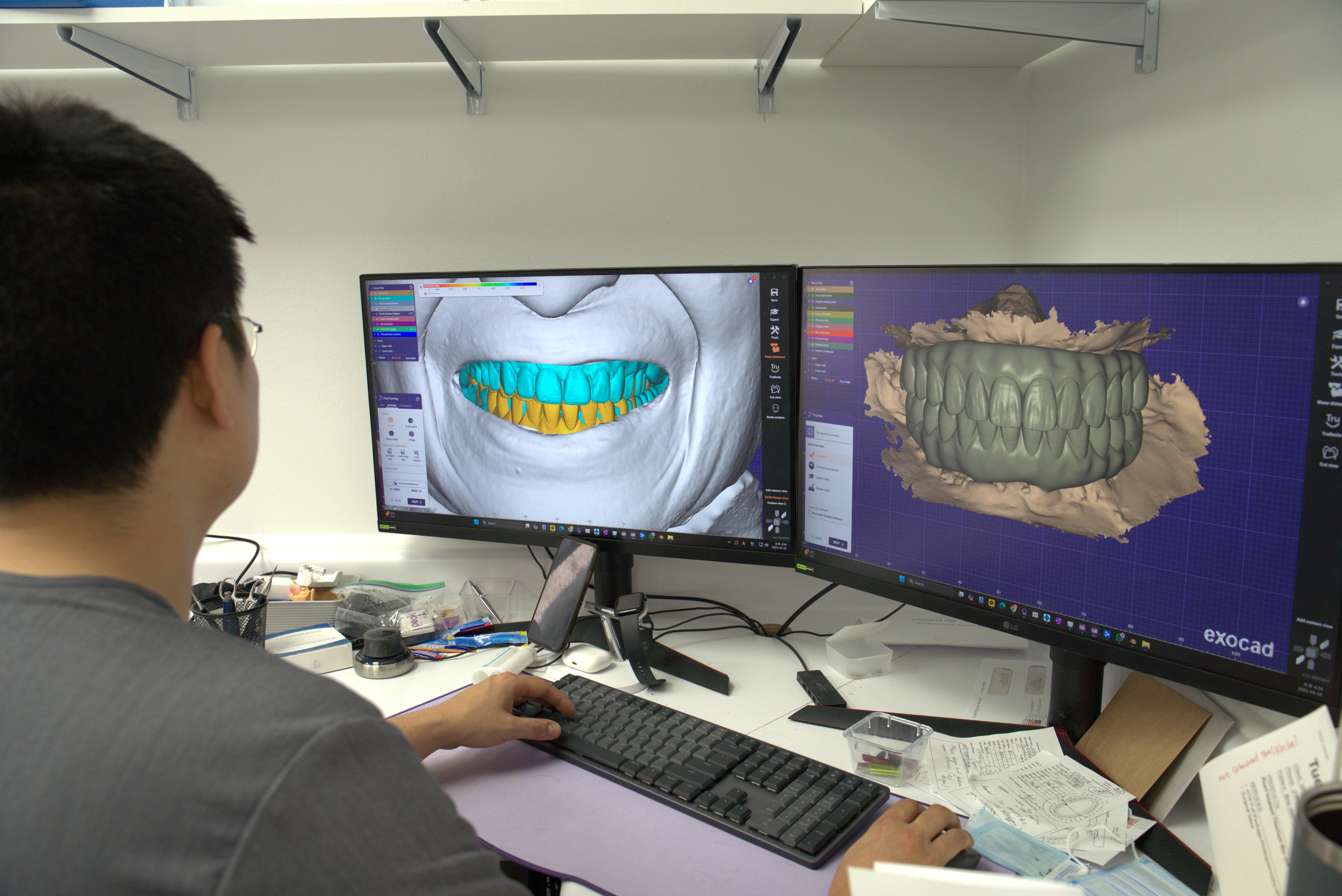 Pearl Dental Services Lab