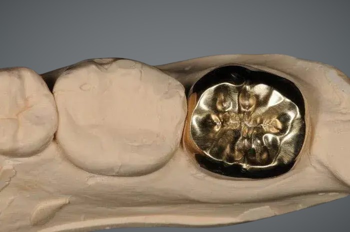 Full Cast Gold
