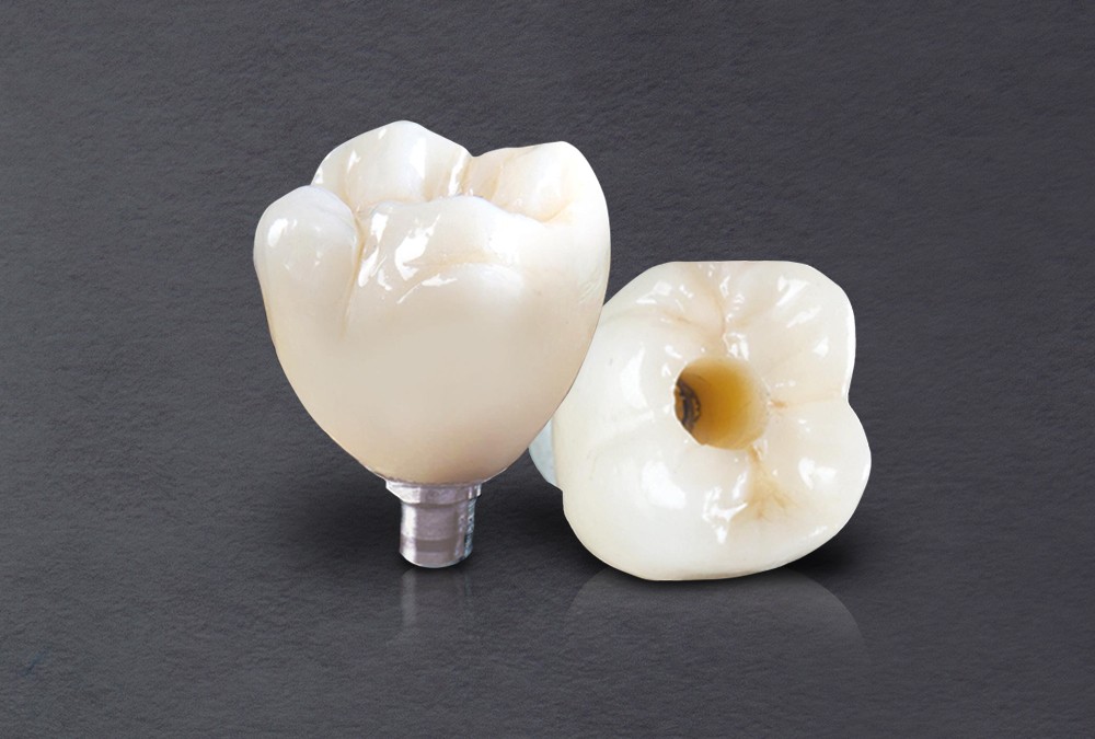Titanium Custom Abutment